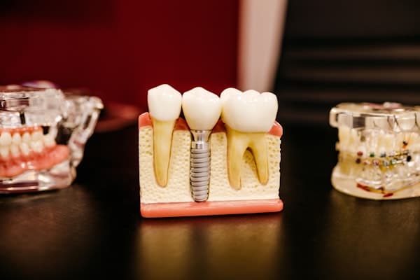 Dental Implants & Restorations