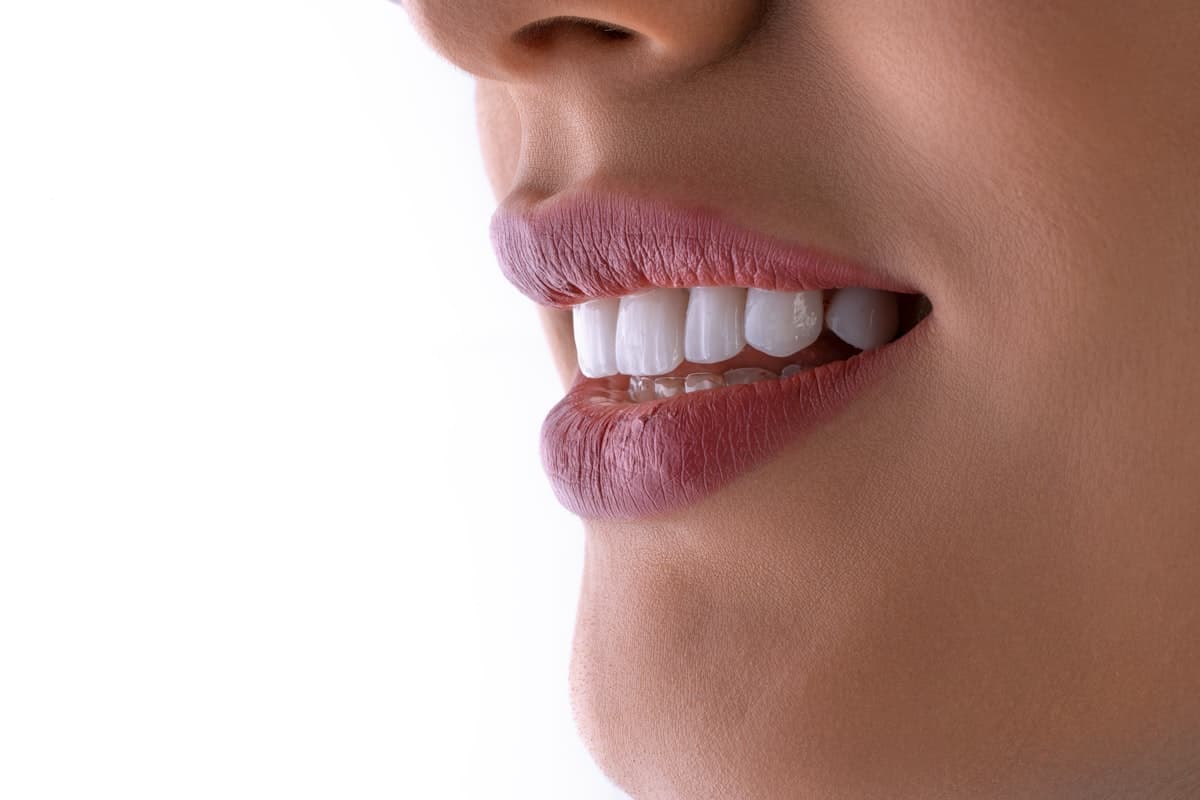 Close-up of a bright, healthy smile